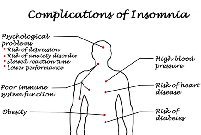 Complications of Insomnia.