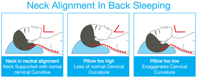 Choosing a Pillow to Relieve Neck Pain 